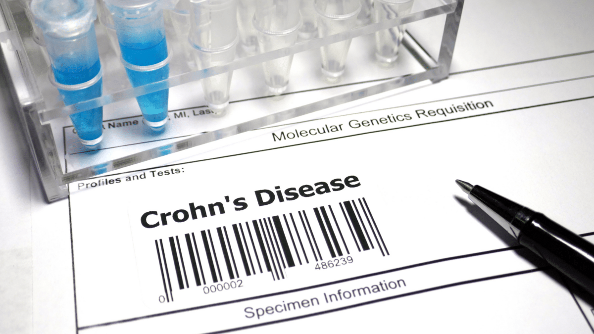 Crohn’s Disease & Crohn’s Colitis Service