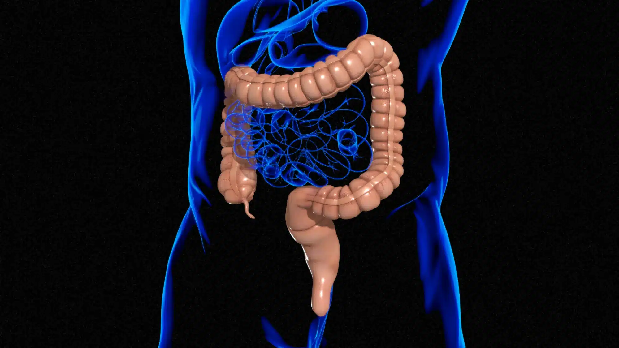 When to Upgrade to Maintenance Colonoscopy_ Personalized Scheduling for GI Wellness When to Upgrade to Maintenance Colonoscopy_ Personalized Scheduling for GI Wellness